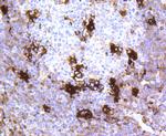MERTK Antibody in Immunohistochemistry (Paraffin) (IHC (P))