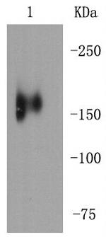 MERTK Antibody in Western Blot (WB)