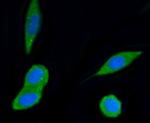 PI3K p55 gamma Recombinant Rabbit Monoclonal Antibody (SR44-06)
