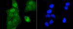 H2AK9ac Antibody in Immunocytochemistry (ICC/IF)