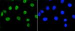 Phospho-Rb (Ser807) Antibody in Immunocytochemistry (ICC/IF)