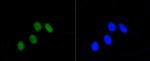 Phospho-Rb (Ser807) Recombinant Rabbit Monoclonal Antibody (SR3-82)