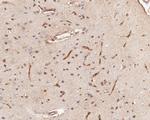 IFNAR1 Antibody in Immunohistochemistry (Paraffin) (IHC (P))