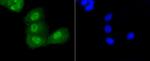 Acetyl-P53 (Lys370) Antibody in Immunocytochemistry (ICC/IF)