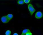 beta-5 Tubulin Antibody in Immunocytochemistry (ICC/IF)
