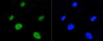 H4K5ac Antibody in Immunocytochemistry (ICC/IF)
