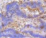 H3K79me1me2me3 Recombinant Rabbit Monoclonal Antibody (SR42-06)