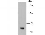 Firefly luciferase Recombinant Rabbit Monoclonal Antibody (SR03-86)