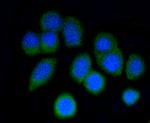 ARPC5 Recombinant Rabbit Monoclonal Antibody (SR34-02)