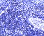 SATB1 Antibody in Immunohistochemistry (Paraffin) (IHC (P))