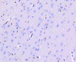 ERG Antibody in Immunohistochemistry (Paraffin) (IHC (P))