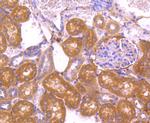 VEGF Antibody in Immunohistochemistry (Paraffin) (IHC (P))