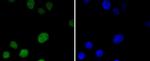 MSH6 Recombinant Rabbit Monoclonal Antibody (SP08-02)