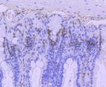 MSH6 Antibody in Immunohistochemistry (Paraffin) (IHC (P))