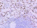 HO-1 Recombinant Rabbit Monoclonal Antibody (SP08-07)