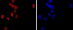 PMS2 Antibody in Immunohistochemistry (Paraffin) (IHC (P))