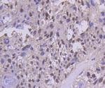 PMS2 Antibody in Immunohistochemistry (Paraffin) (IHC (P))