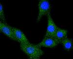 VEGF Receptor 1 Recombinant Rabbit Monoclonal Antibody (SY09-09)