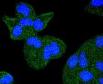 TACC3 Antibody in Immunocytochemistry (ICC/IF)