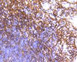 CD140b (PDGFRB) Recombinant Rabbit Monoclonal Antibody (SY10-08)