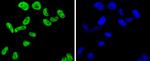 FUBP1 Antibody in Immunocytochemistry (ICC/IF)