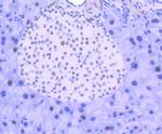 FUBP1 Antibody in Immunohistochemistry (Paraffin) (IHC (P))