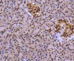 FUBP1 Antibody in Immunohistochemistry (Paraffin) (IHC (P))