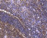 FUBP1 Antibody in Immunohistochemistry (Paraffin) (IHC (P))