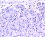 FUBP1 Antibody in Immunohistochemistry (Paraffin) (IHC (P))