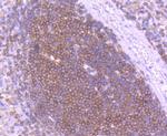 SHIP1 Recombinant Rabbit Monoclonal Antibody (SY11-08)
