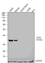 CD20 Antibody