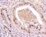 Phospho-p53 (Ser392) Antibody in Immunohistochemistry (Paraffin) (IHC (P))