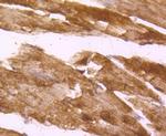Desmin Antibody in Immunohistochemistry (Paraffin) (IHC (P))