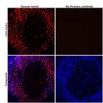 CD8 alpha Antibody in Immunohistochemistry (Paraffin) (IHC (P))