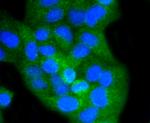 CD8 alpha Antibody in Immunocytochemistry (ICC/IF)