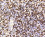 CD8 alpha Antibody in Immunohistochemistry (Paraffin) (IHC (P))