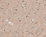 PIK3CA Antibody in Immunohistochemistry (Paraffin) (IHC (P))