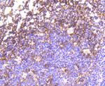 Phospho-EGFR (Tyr1092) Antibody in Immunohistochemistry (Paraffin) (IHC (P))