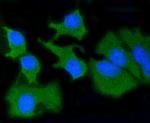 MMP14 Recombinant Rabbit Monoclonal Antibody (SJ18-09)