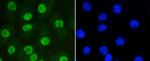 SUMO1 Antibody in Immunocytochemistry (ICC/IF)
