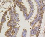 SUMO1 Antibody in Immunohistochemistry (Paraffin) (IHC (P))