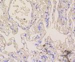 NOTCH1 Antibody in Immunohistochemistry (Paraffin) (IHC (P))