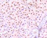 Phospho-STAT3 (Ser727) Antibody in Immunohistochemistry (Paraffin) (IHC (P))