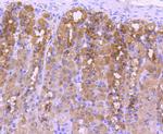 NOX4 Antibody in Immunohistochemistry (Paraffin) (IHC (P))