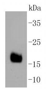 DNAJC15 Recombinant Rabbit Monoclonal Antibody (SY26-04)