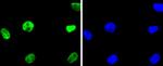 HDAC2 Recombinant Rabbit Monoclonal Antibody (SY29-02)