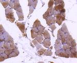 Plectin Antibody in Immunohistochemistry (Paraffin) (IHC (P))
