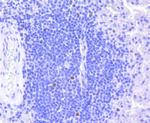 Rb Antibody in Immunohistochemistry (Paraffin) (IHC (P))