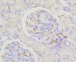 Caldesmon Antibody in Immunohistochemistry (Paraffin) (IHC (P))