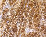 Caldesmon Antibody in Immunohistochemistry (Paraffin) (IHC (P))